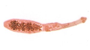 Эхинококк - это один из видов ленточных червей.