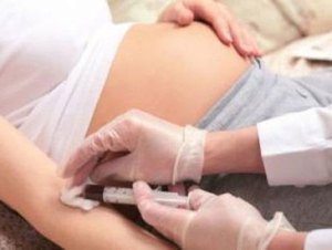 Важно при обследовании беременных своевременно выявить холестаз.
