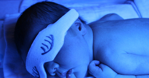 Какова норма билирубина у новорожденных?