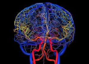 Очищение сосудов головного мозга проводится в случае заболеваний.