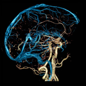 МРТ - это исследование, которое показывает состояние головного мозга и сосудов в нем.